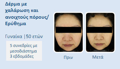 ice_screenshot_20230613-143958