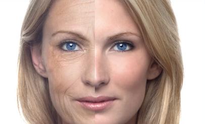 Derma Laser Aesthetics - Δρ. Σταματίνα Γελέκη | BOTOX vs ΥΑΛΟΥΡΟΝΙΚΟ ΓΙΑ ΤΙΣ ΡΥΤΙΔΕΣ ΤΟΥ ΜΕΤΩΠΟΥ ΚΑΙ ΤΩΝ ΜΑΤΙΩΝ
