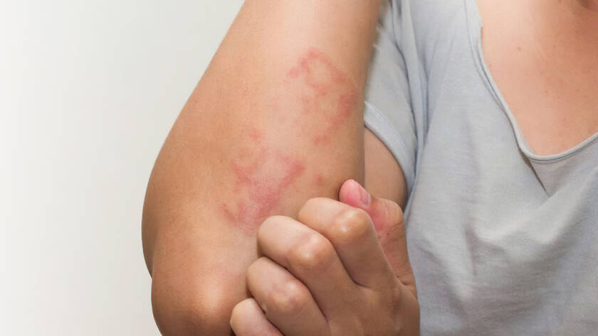 Derma Laser Aesthetics - Δρ. Σταματίνα Γελέκη | Ατοπική Δερματίτιδα: Η αρχή της νόσου, η αλλεργική πορεία και η θεραπεία από τον Δερματολόγο.