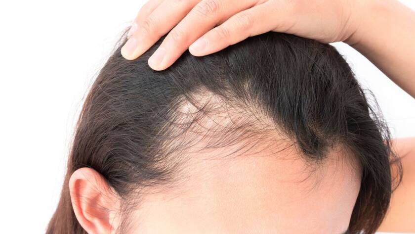 Derma Laser Aesthetics - Δρ. Σταματίνα Γελέκη | TrichoTest™ DNA Τεστ για την Αλωπεκία
