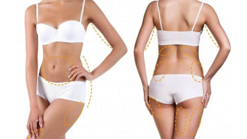 Derma Laser Aesthetics - Δρ. Σταματίνα Γελέκη | Λιποαναρρόφηση vs Κρυολιπόλυση