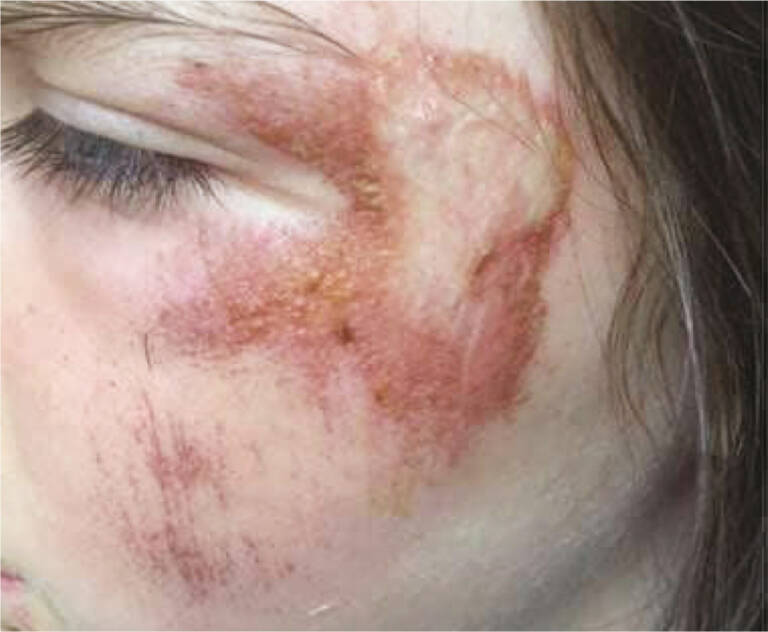 Derma Laser Aesthetics - Δρ. Σταματίνα Γελέκη | INDIBA ΚΑΙ ELITE NS - DEEP CARE AND DEEP BEAUTY