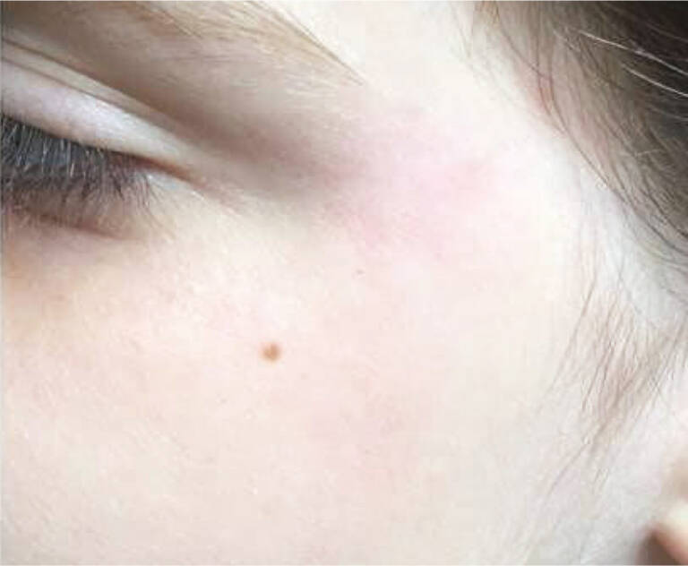 Derma Laser Aesthetics - Δρ. Σταματίνα Γελέκη | INDIBA ΚΑΙ ELITE NS - DEEP CARE AND DEEP BEAUTY