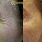 Derma Laser Aesthetics - Δρ. Σταματίνα Γελέκη | Botox